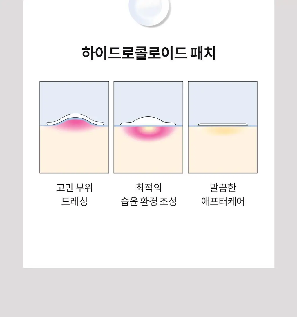 [경동제약] 하피도피 패치 클리어 88매 +핀셋동봉 (짜고 난 후) 상세페이지 20